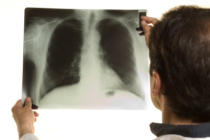 Doctor looking at an x-ray image