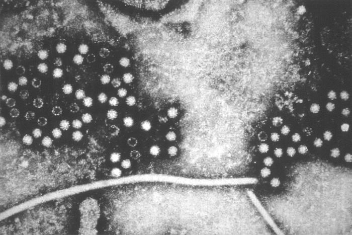 This transmission electron micrograph depicts numerous, spheroid-shaped, hepatitis-E viruses (HEV).