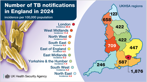 UKHSA TB infographics 2025