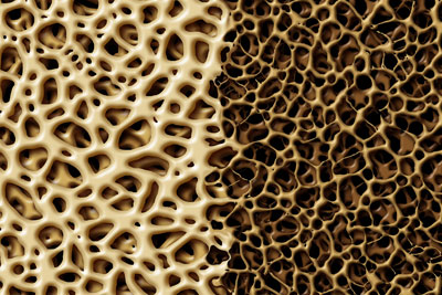 gold texture microscopic level