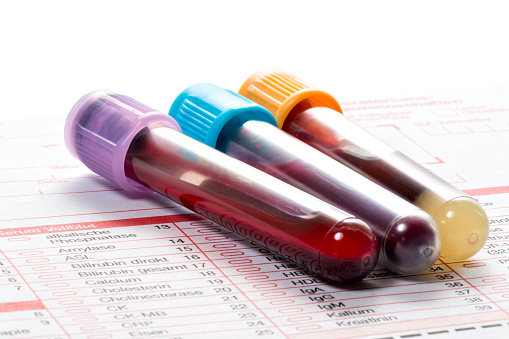 Image of 3 blood vials on results sheet