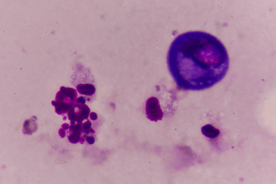 Purple slide under microscope screening