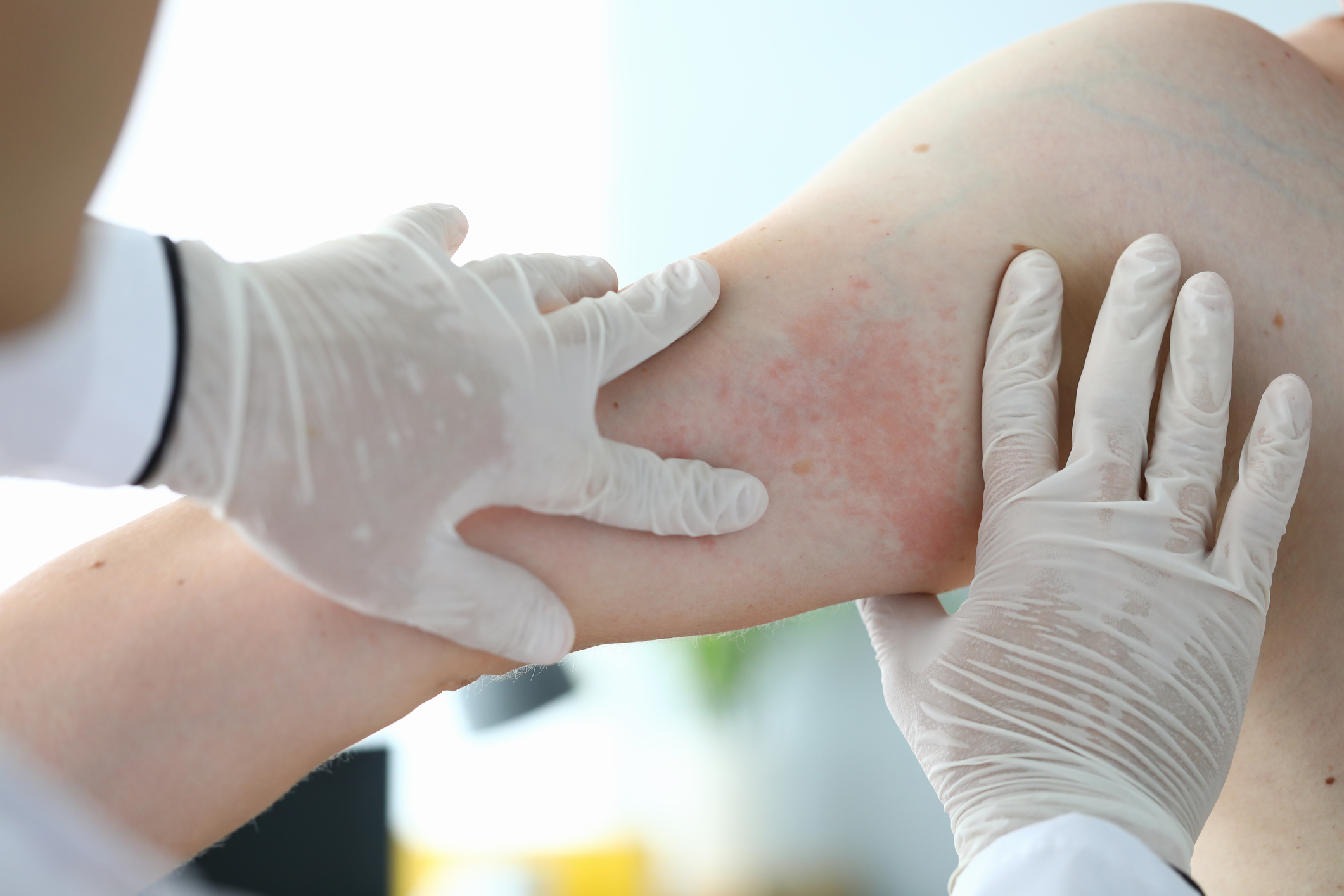 Dermatology