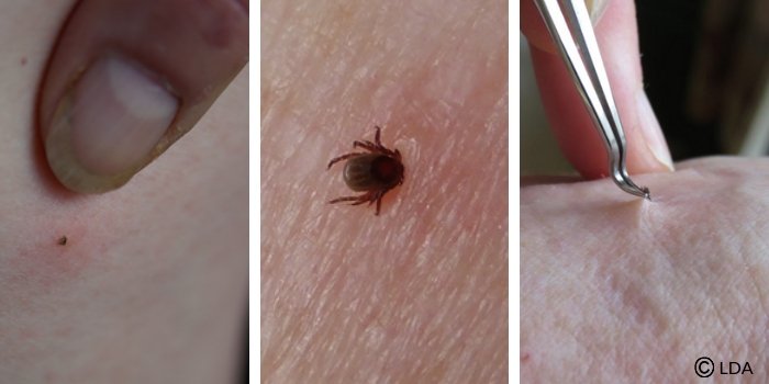 three images together showing ticks