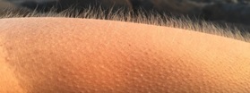 A person's arm with upright hairs and goosebumps