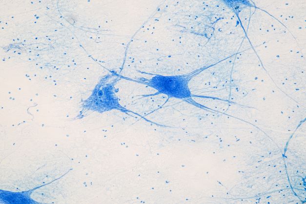 Zoom in of neurons 