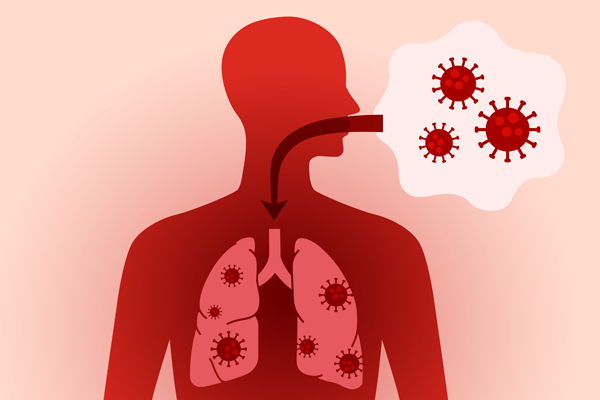 Respiratory tract infections