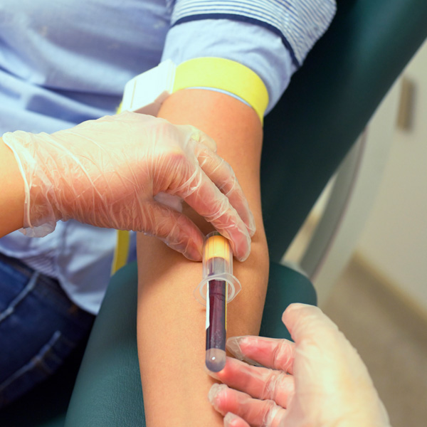 Rational testing in primary care