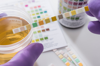 Defining recurrent urinary tract infections and quantifying bladder cancer risk in primary care in England