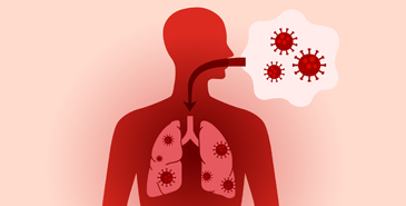 Respiratory tract infections