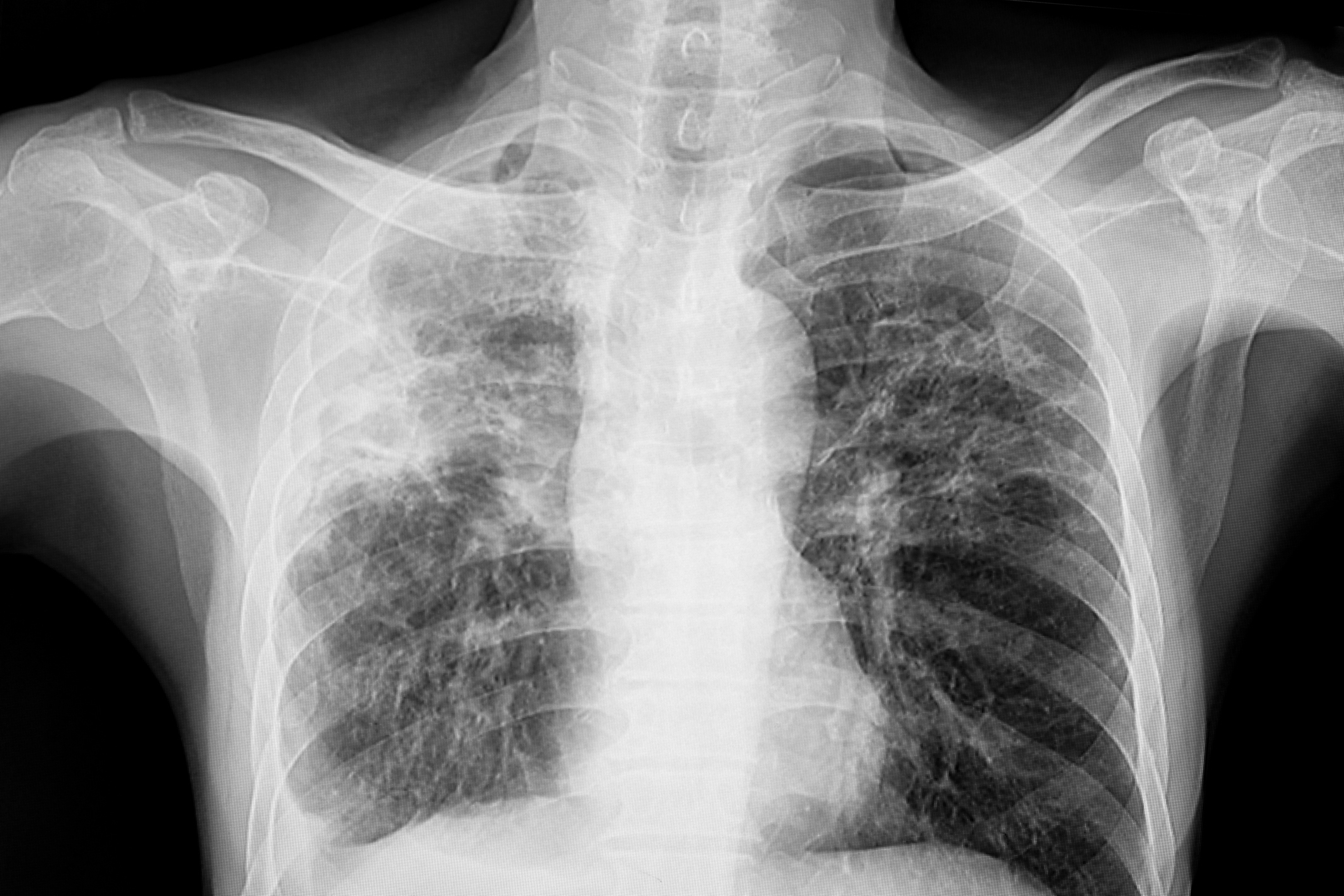 Doctor looking at an x-ray image