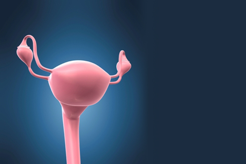 Bloating and Other Abdominal Symptoms: Could it be Ovarian Cancer?